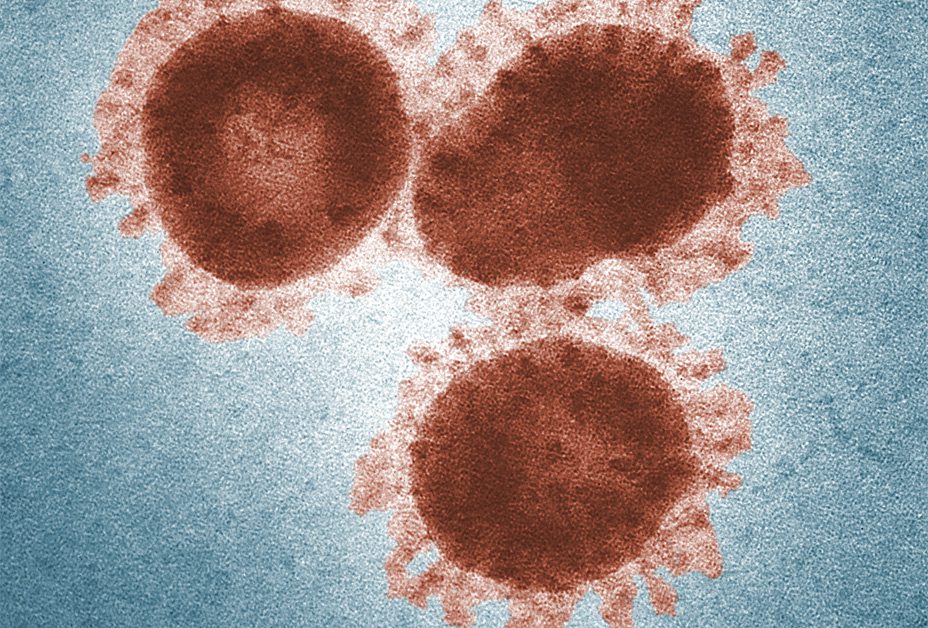 SARS Coronavirus - Top 10 List Of Worst Health Viruses Of All Time